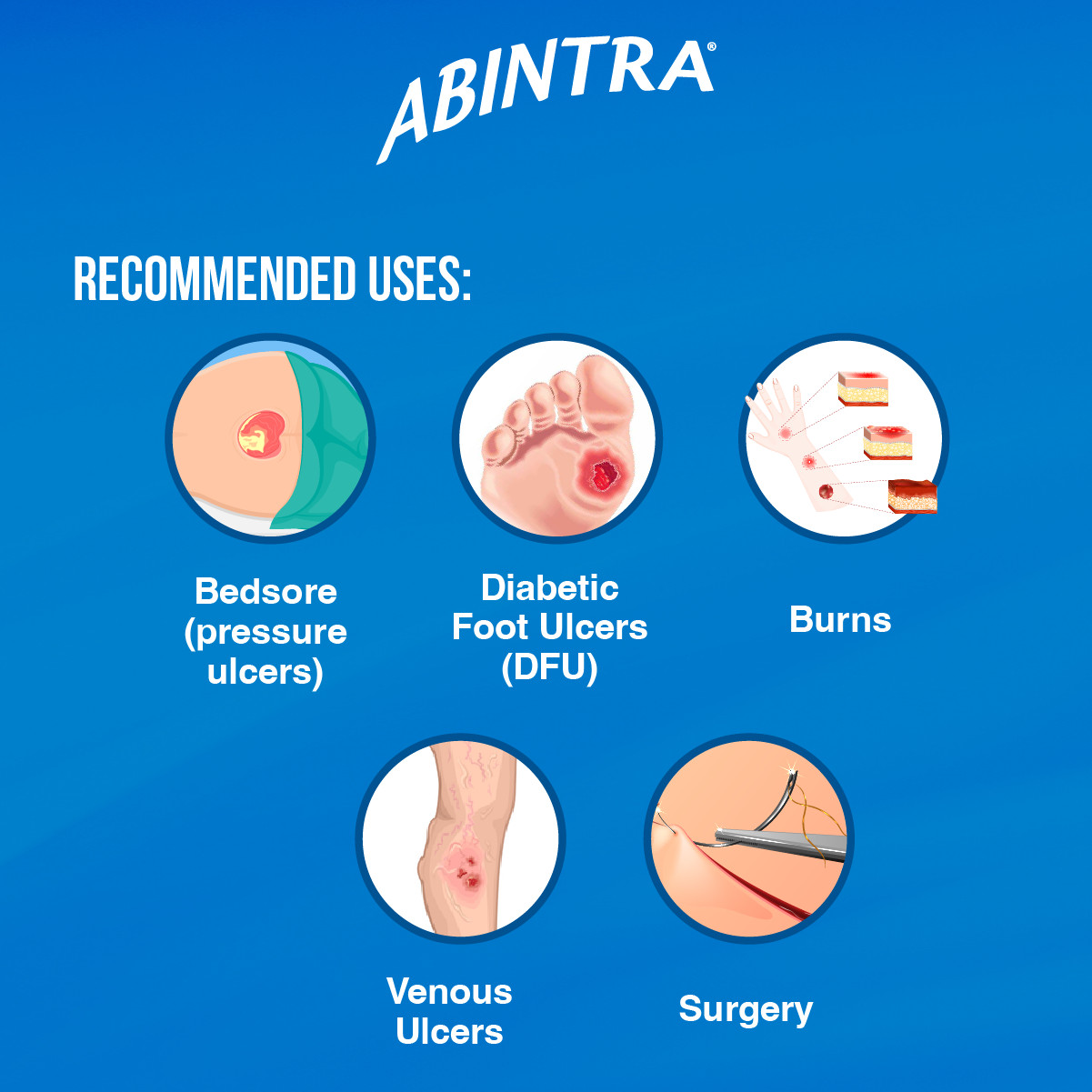 ABINTRA Specialized Nutrition for Wound Healing – Orange Flavor