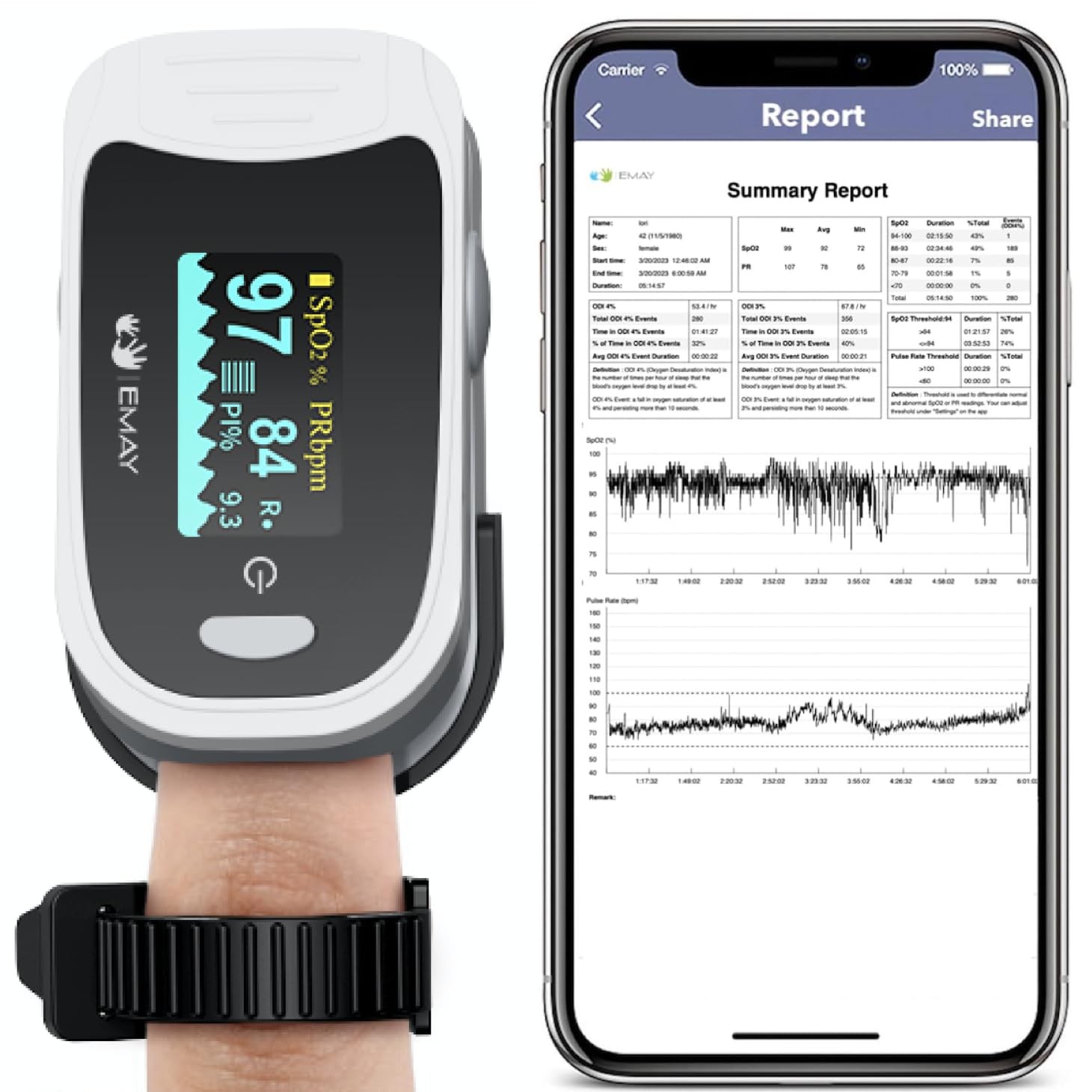EMAY Sleep Oxygen Monitor with Built-in Recording Capability | Track Continuou