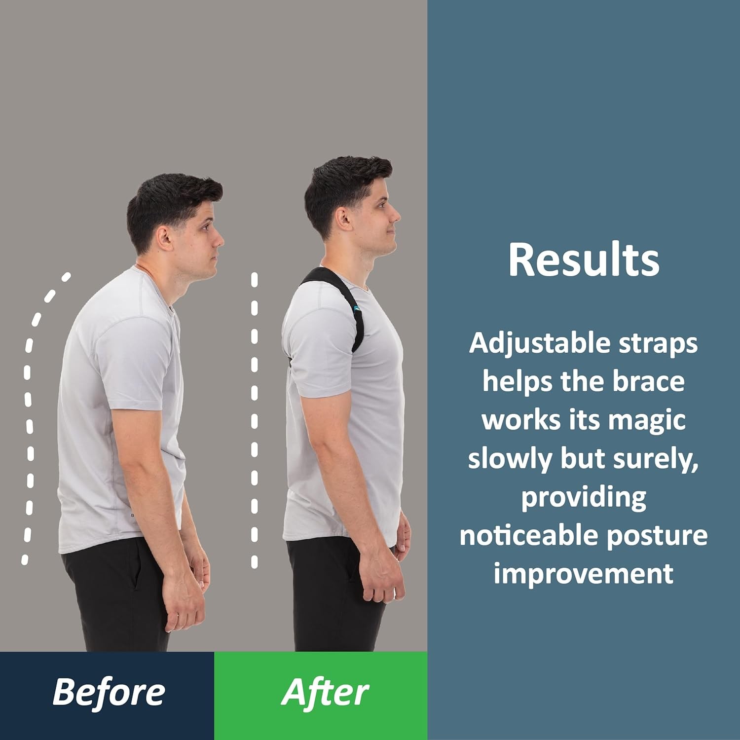 ComfyBrace Posture Corrector for Men and Women, Back Brace Straightener